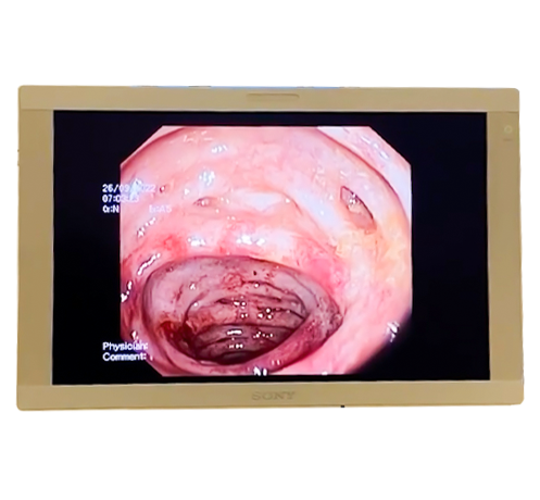 Qatroenterologiya